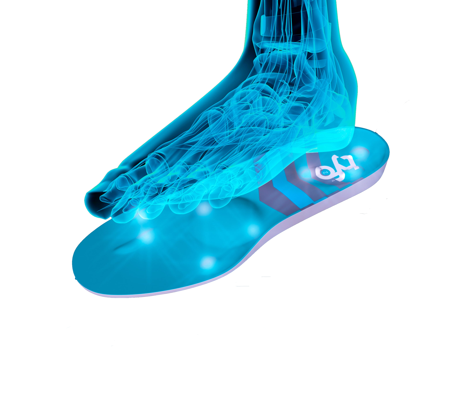 PLANTAR FASCIITIS TYFO